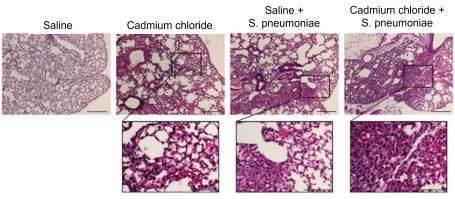 Seven images of mice lungs exposed to saline, cadmium chloride, Saline + S. pheumoniae, and cadmium chloride and S. pneumoniae. Images show mice exposed to cadmium with more macrophages in their lungs as well as lung injury indicated by cellular inflammation.